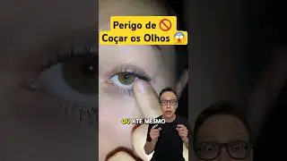 Coçar os Olhos 😱