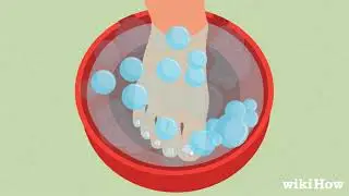 How to Remove a Dead Toenail