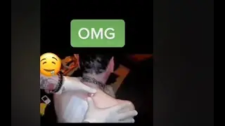 *MASSIVE POPS* Big Pimples, Cysts, and Stye Popping Compilation | Best of Tiktok