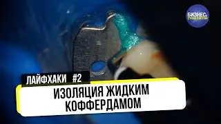 Изоляция коффердамом | Лайфхак #2