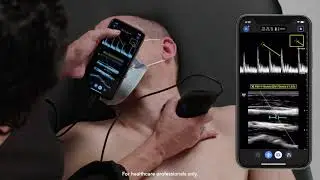 Ultrasound Education: Pulsed Wave Doppler mode on the Vascular: Carotid Preset