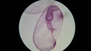 Starfish Development, Early Cleavage through Gastrulation through Early Bipinnaria Larva