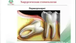 Хирургическая стоматология и Дета технологии