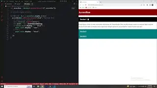 Learn How to Make an Accordion in just 10 minutes using JavaScript!