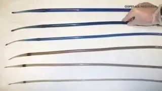 Dilatazione endoscopica di un restringimento del tratto gastrointestinale