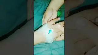 How to remove cannula at Home Without pain . #howtoremovecannula #doctor #cannula #neetaspirant