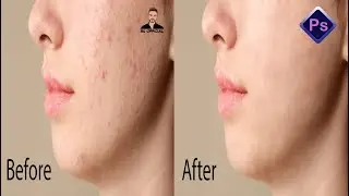 Face Retouching in Adobe Photoshop CS6 with Patch Tool 2022 | ছবি থেকে দাগ দূর করুন | SU Official