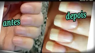 COMO TER UNHAS GRANDES EM 2 DIAS