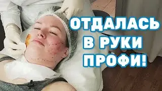 💆Улётный нитевой лифтинг лица, нити коги (COG) в Зеленограде. Салон красоты в Зеленограде.