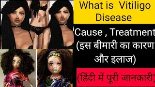 What is Vitiligo Disease|| Causes & Treatment (हिंदी में पूरी जानकारी)||सफेद धब्बे की बीमारी||