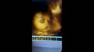 УЗИ .Что делают малыши в животике. Первая улыбка