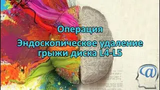 Операция. Эндоскопическое удаление грыжи межпозвонкового диска L4-L5. Нейрохирургия