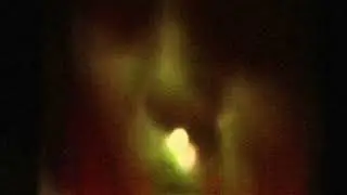 Jacob Stoy - Brain