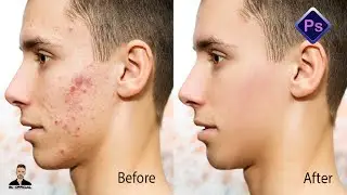 Skin Retouching in Adobe Photoshop CS6 with Healing Brush Tool 2022 |  SU Official