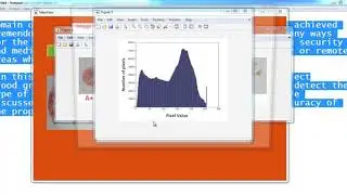 Blood Group Identification Image Processing Matlab Projects
