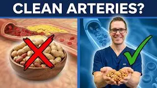 3 WORST Nuts & 9 BEST Nuts [For Diabetes, Heart & Clogged Arteries]