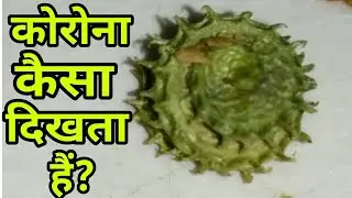 कोरोना वायरस असली में कैसा दिखता है? What does the corona virus look like In Real ?