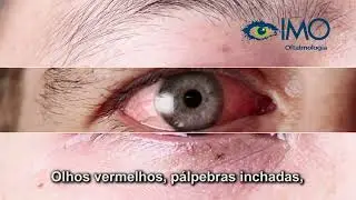 IMO - Conjuntivite