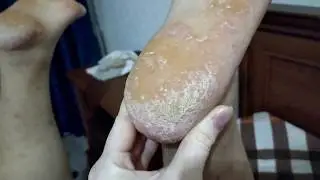 Не Делайте Так Никогда, ИСПОРТИТЬ пятки Уксусом