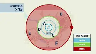 Liver Distribution- Example 3