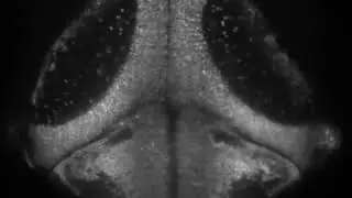 QBI lightsheet imaging larval zebrafish