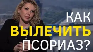 Как лечить псориаз! 18+
