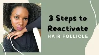 Activate your stem cells for hair growth - Thicken hair in your bald spots in 90 Days !!! Part 1