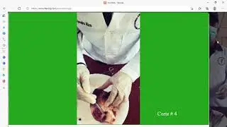 Diseccion de Corazón Facmed