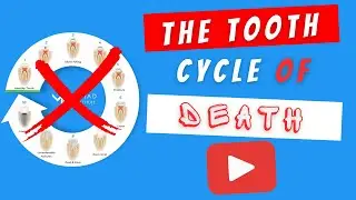 Save Teeth from Extractions & Root Canals | Biomimetic Dentistry & the 
