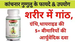 कांचनार गुग्गुलु के फायदे | Kanchnar Guggul Benefits | Dosage | Uses & Side Effects in hindi