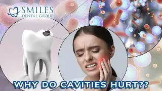 What is a CAVITY?  How to prevent DENTAL DECAY!