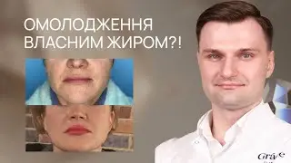 ЛІПОФІЛІНГ ОБЛИЧЧЯ: молодження власним жиром Grace Clinic