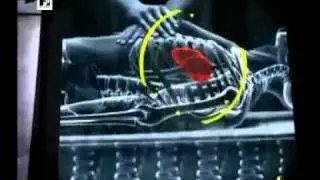 Especial MTV: La misteriosa muerte del rey del pop
