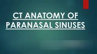 Paranasal sinuses CT anatomy - SIMPLIFIED