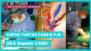 CABG ITU APA SIH? Kupas tuntas tentang CABG & PJK + Q&A seputar CABG!