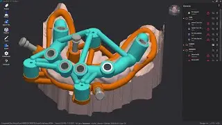 Webinar Implant 3D Sculpt