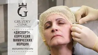 «Диспорт». Коррекция мимических морщин.