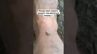 Иногда наши защиты мешают нам двигаться вперёд 🥴.