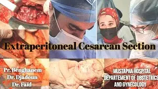 Extraperitoneal cesarean section technique / Césarienne extra-péritonéale