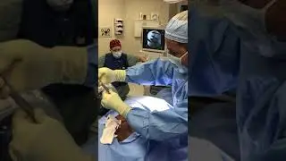 Dr. Medina-Sanchez performs SI Joint Fusion - PPOA