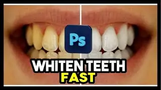 whiten teeth  in 2min