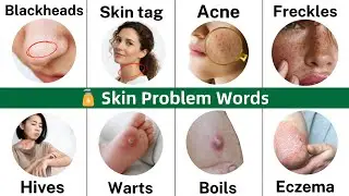 Skin Problems Vocabulary in English | Health Problems and Disease Words