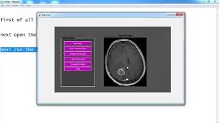 Image Registration Using Conjugate Gradient Backpropagation Matlab Projects