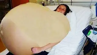 RARE HUMANS THAT ARE ONE IN A MILLION!! #18