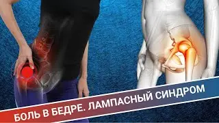 БОЛЬ В БЕДРЕ || ЛАМПАСНЫЙ СИНДРОМ