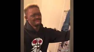 CET HOMME EST DEVENU CÉLÈBRE GRACE A SON VISAGE ATYPIQUE!