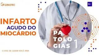 Infarto Agudo do Miocárdio - Causas, sintomas e tratamentos