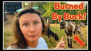 🔥 Injured! Burned by my BUCK 🔥
