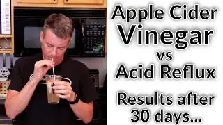 How I Got Off Acid Reflux Medication After 15 Years (Natural Remedy)