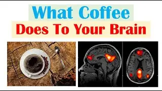 Coffee and the Brain (Default Mode Network, Visual Cortex, Right Executive Control Network)